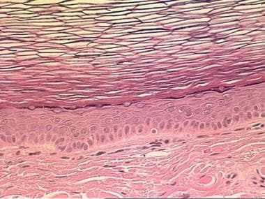 Higher-magnification view of the cyst wall of the 