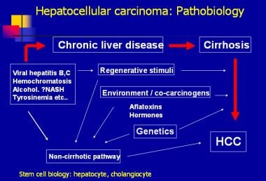 Hepatocellular carcinoma: pathobiology. 
