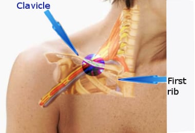 subclavian artery and vein