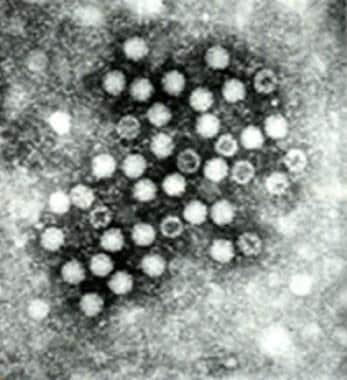 通过电子微观观察的甲型肝炎病毒