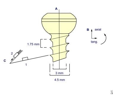 Common screw. 