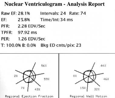 Measured global left ventricular ejection fraction