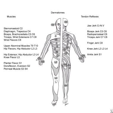 Complications of Spinal Cord Stimulator