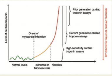 Cardiac Markers. This graph describes the improved