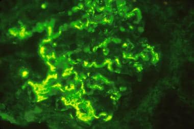 Immunofluorescence microscopy demonstrating large 