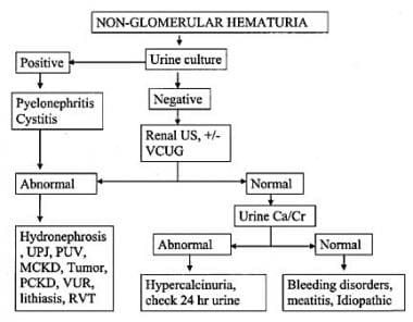 Nonglomerular hematuria. 