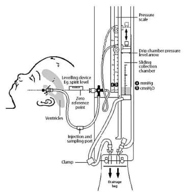 Diagram illustrating ventricular drainage system. 