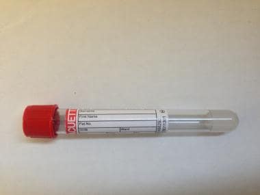 Serum vacuette 6-mL tube. 