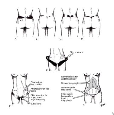 Overview of our system. Our system first estimates the body-contour