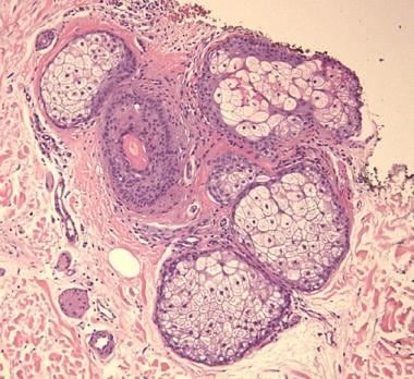 sebaceous glands histology