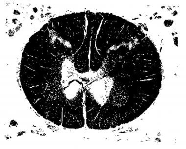 Transverse section of spinal cord at T12-L1 showin