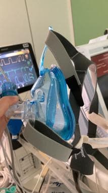 Noninvasive ventilation face mask that covers nose