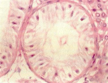 This hematoxylin and eosin section of a testis bio