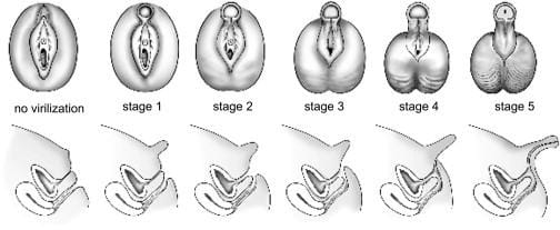http://emedicine.medscape.com/article/924291-clinical#b4
