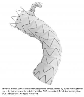Medtronic Thoracic Branch Stent Graft. Courtesy of