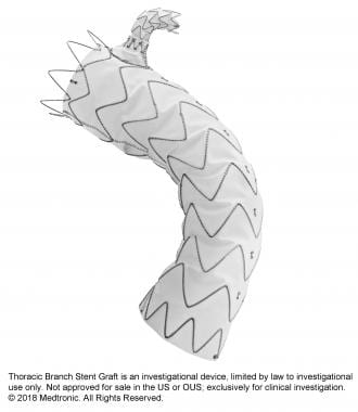 GORE® TAG® Conformable Thoracic Stent Graft with ACTIVE CONTROL