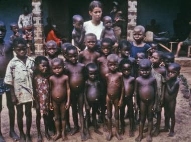 This photograph shows children and a nurse attenda