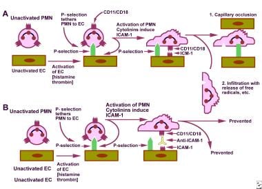 A. Schematic representation of the process of endo