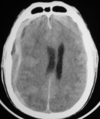 Computed tomography (CT) scan demonstrating a pati