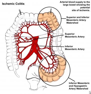 Arterial blood supply to the large bowel shows the