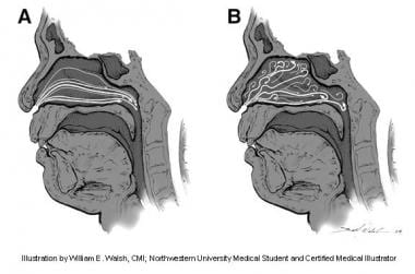 examination of nose anatomy