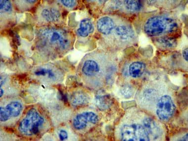 In this photomicrograph, immunohistochemical stain
