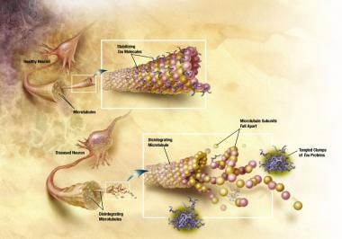 Healthy neurons. Image courtesy of NIH. 