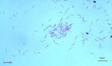 trypanosoma cruzi epimastigote