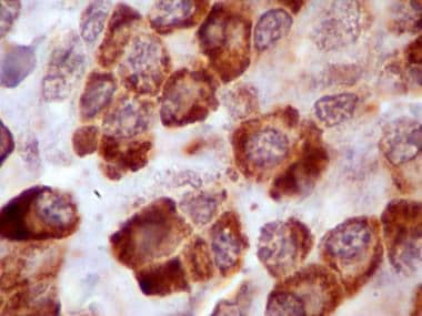 In this photomicrograph, immunohistochemical stain