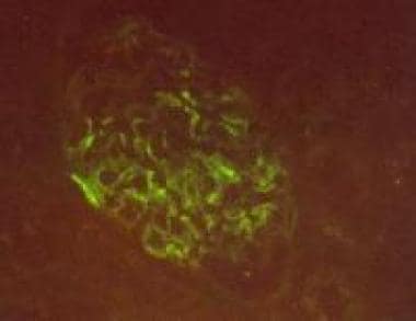 This image of direct immunofluorescence shows smoo