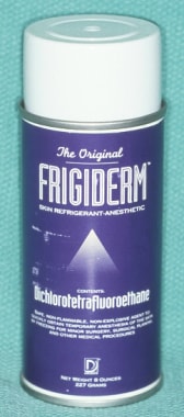 Frigiderm is an effective spray refrigerant used i