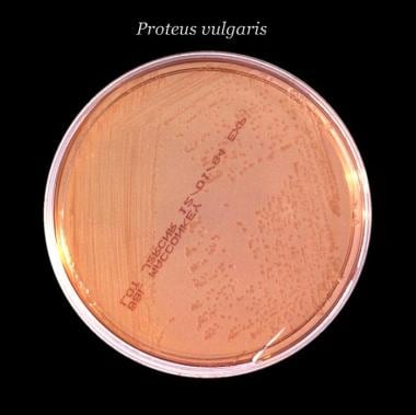 After 24 hours, this inoculated MacConkey agar cul