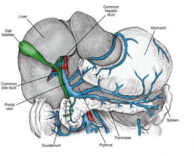 Pancreatosplenectomy and Spleen-Preserving Distal Pancreatectomy