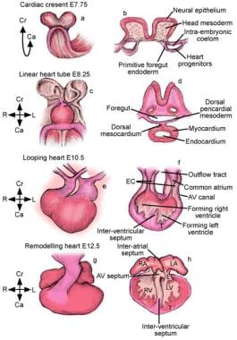 Aortic Valve Anatomy Overview Gross Anatomy Microscopic