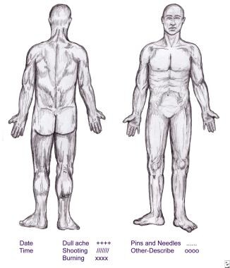 Whole Body Impairment Rating Chart