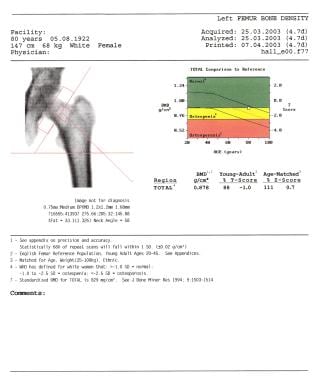 Get screened for osteoporosis using DEXA scans