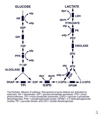 Jaundice  Pyruvate Kinase Deficiency