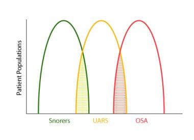 Obstructive Sleep Apnea (OSA): Practice Essentials, Background,  Pathophysiology