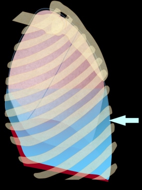 Illustration of the chest, depicted in an upright 