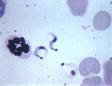 Trypanosoma cruzi trypomastigotes in a mouse blood