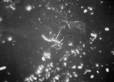 Photomicrograph (540X) of Treponema carateum obtai