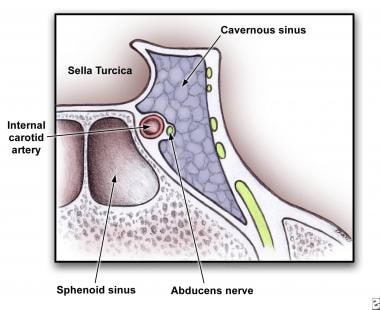 Anatomy of cross section of cavernous sinus showin