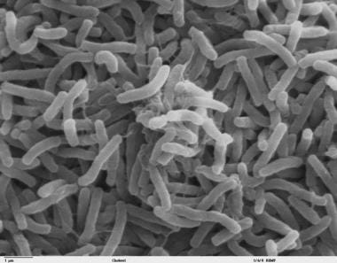 Scanning electron microscope image of Vibrio chole