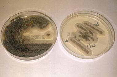 Glucose-peptone agar culture plates revealing colo