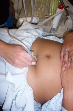 Transverse probe placement for transabdominal obst