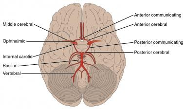 Willis环和脑血管的示意图
