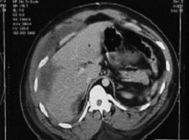 CT scan of 25-year-old man who presented with two 