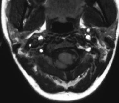 Axial T1-weighted magnetic resonance image of the 