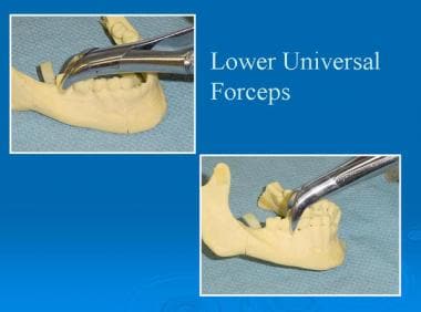 Lower universal forceps No. 151. 