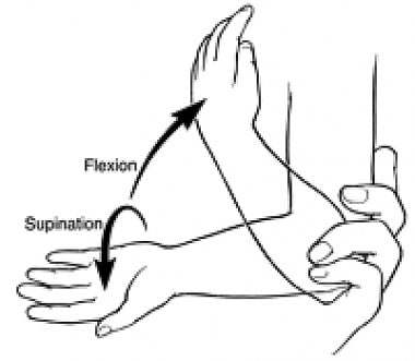 Reduction of subluxated radial head: supination-fl